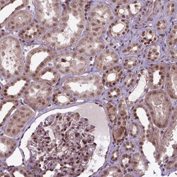 Invitrogen ZNF630 Polyclonal Antibody 100 &mu;L; Unconjugated:Antibodies,