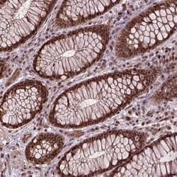 Invitrogen ZNF630 Polyclonal Antibody 100 &mu;L; Unconjugated:Antibodies,