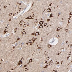 Invitrogen PSD3 Polyclonal Antibody 100 &mu;L; Unconjugated:Antibodies,
