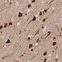 Invitrogen PSD3 Polyclonal Antibody 100 &mu;L; Unconjugated:Antibodies,