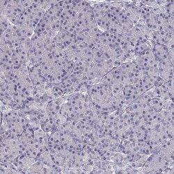 Invitrogen SLC18A1 Polyclonal Antibody 100 &mu;L | Buy Online | Invitrogen&trade; | Fisher Scientific