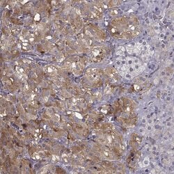 Invitrogen SLC18A1 Polyclonal Antibody 100 &mu;L | Buy Online | Invitrogen&trade; | Fisher Scientific