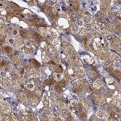 Invitrogen SLC18A1 Polyclonal Antibody 100 &mu;L | Buy Online | Invitrogen&trade; | Fisher Scientific