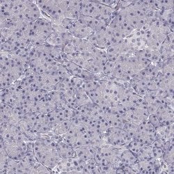 Invitrogen SLC18A1 Polyclonal Antibody 100 &mu;L | Buy Online | Invitrogen&trade; | Fisher Scientific