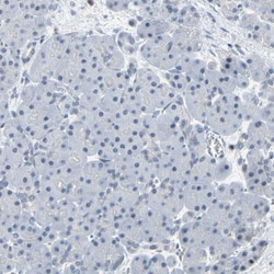 Invitrogen IMPG2 Polyclonal Antibody 100 &mu;L; Unconjugated:Antibodies,