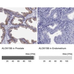 ALOX15B Polyclonal Antibody, Invitrogen 100 &mu;L | Buy Online | Thermo Scientific | Fisher Scientific