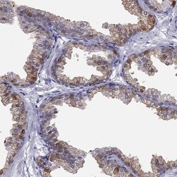 ALOX15B Polyclonal Antibody, Invitrogen 100 &mu;L | Buy Online | Thermo Scientific | Fisher Scientific