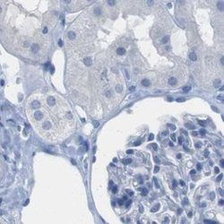 Invitrogen Opsin Blue Polyclonal Antibody 100 &mu;L; Unconjugated:Antibodies,
