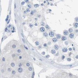Invitrogen Opsin Blue Polyclonal Antibody 100 &mu;L; Unconjugated:Antibodies,
