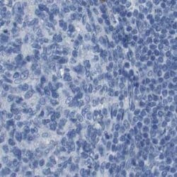 Invitrogen Opsin Blue Polyclonal Antibody 100 &mu;L; Unconjugated:Antibodies,
