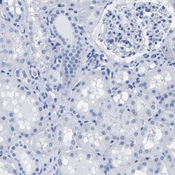 Invitrogen IMPG2 Polyclonal Antibody 100 &mu;L; Unconjugated:Antibodies,
