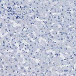 Invitrogen IMPG2 Polyclonal Antibody 100 &mu;L; Unconjugated:Antibodies,