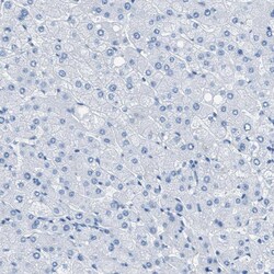 Invitrogen MGARP Polyclonal Antibody 100 &mu;L; Unconjugated:Antibodies,
