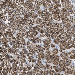 Invitrogen MGARP Polyclonal Antibody 100 &mu;L; Unconjugated:Antibodies,