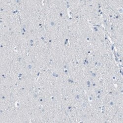 Invitrogen MGARP Polyclonal Antibody 100 &mu;L; Unconjugated:Antibodies,