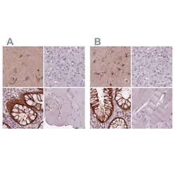 Invitrogen Sorcin Polyclonal Antibody 100 &mu;L; Unconjugated:Antibodies,