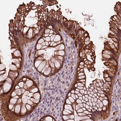 Invitrogen Sorcin Polyclonal Antibody 100 &mu;L; Unconjugated:Antibodies,