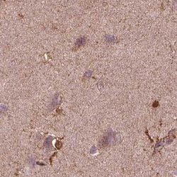 Invitrogen Sorcin Polyclonal Antibody 100 &mu;L; Unconjugated:Antibodies,
