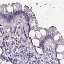 Invitrogen IMPG1 Polyclonal Antibody 100 &mu;L; Unconjugated:Antibodies,
