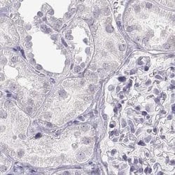Invitrogen IMPG1 Polyclonal Antibody 100 &mu;L; Unconjugated:Antibodies,