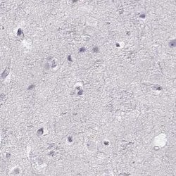 Invitrogen IMPG1 Polyclonal Antibody 100 &mu;L; Unconjugated:Antibodies,
