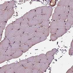 HTR1B Polyclonal Antibody, Invitrogen 100 &mu;L; Unconjugated:Antibodies,