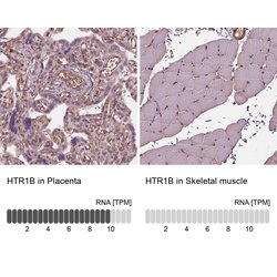 HTR1B Polyclonal Antibody, Invitrogen 100 &mu;L; Unconjugated:Antibodies,