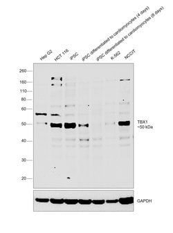 Invitrogen TBX1 Polyclonal Antibody 100 &mu;L; Unconjugated:Antibodies,