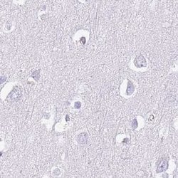 Invitrogen IMPG1 Polyclonal Antibody 100 &mu;L | Buy Online | Invitrogen&trade; | Fisher Scientific