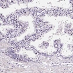 Invitrogen LCA5L Polyclonal Antibody 100 &mu;L; Unconjugated:Antibodies,