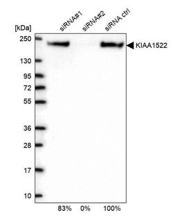 KIAA1522 Polyclonal Antibody:Antibodies, Polyclonal