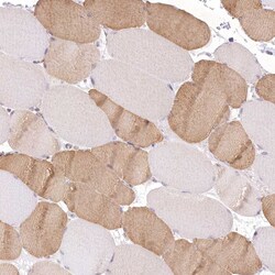 Invitrogen RNPEP Polyclonal Antibody 100 μL; Unconjugated:Antibodies,