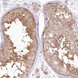 Invitrogen RNPEP Polyclonal Antibody 100 μL; Unconjugated:Antibodies,