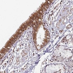 Invitrogen SIMC1 Polyclonal Antibody 100 &mu;L; Unconjugated:Antibodies,