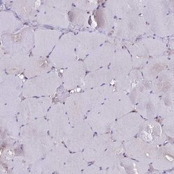 Invitrogen GLYAT Polyclonal Antibody 100 &mu;L | Buy Online | Invitrogen&trade; | Fisher Scientific