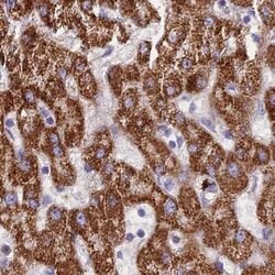 Invitrogen GLYAT Polyclonal Antibody 100 &mu;L | Buy Online | Invitrogen&trade; | Fisher Scientific