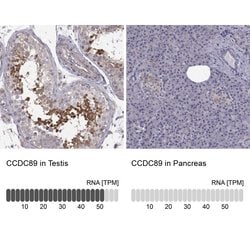 Invitrogen Ccdc89 Polyclonal Antibody 100 &mu;L; Unconjugated:Antibodies,
