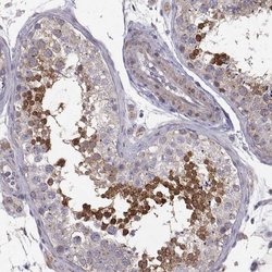 Invitrogen Ccdc89 Polyclonal Antibody 100 &mu;L; Unconjugated:Antibodies,