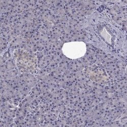 Invitrogen Ccdc89 Polyclonal Antibody 100 &mu;L; Unconjugated:Antibodies,