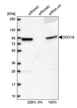 Invitrogen DDX18 Polyclonal Antibody 100 &mu;L; Unconjugated:Antibodies,