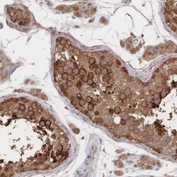 Invitrogen DNAJA4 Polyclonal Antibody 100 &mu;L; Unconjugated:Antibodies,