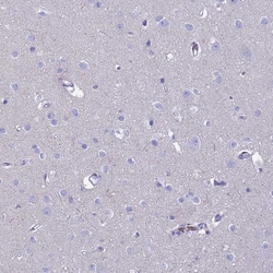 Invitrogen GNGT2 Polyclonal Antibody 100 &mu;L; Unconjugated:Antibodies,