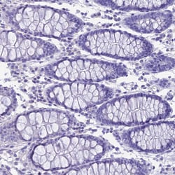 Invitrogen GNGT2 Polyclonal Antibody 100 &mu;L; Unconjugated:Antibodies,