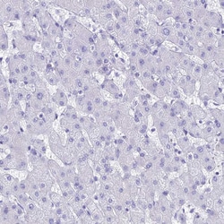 Invitrogen GNGT2 Polyclonal Antibody 100 &mu;L; Unconjugated:Antibodies,