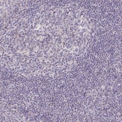 Invitrogen FAHD1 Polyclonal Antibody 100 &mu;L; Unconjugated:Antibodies,
