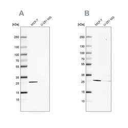 Invitrogen FAHD1 Polyclonal Antibody 100 &mu;L; Unconjugated:Antibodies,