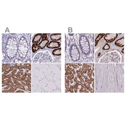 Invitrogen GLYAT Polyclonal Antibody 100 &mu;L; Unconjugated:Antibodies,