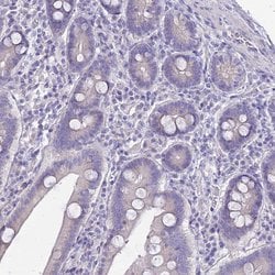 Invitrogen GLYAT Polyclonal Antibody 100 &mu;L; Unconjugated:Antibodies,