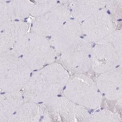 Invitrogen GLYAT Polyclonal Antibody 100 &mu;L; Unconjugated:Antibodies,