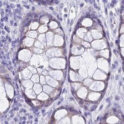 Invitrogen GLYAT Polyclonal Antibody 100 &mu;L; Unconjugated:Antibodies,